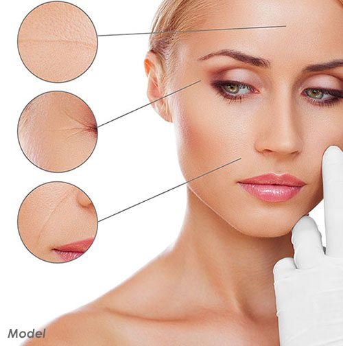 Injectable Skin Treatment Dubai